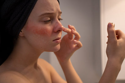 Cuidado de la piel con Rosácea: consejos y cosméticos clave