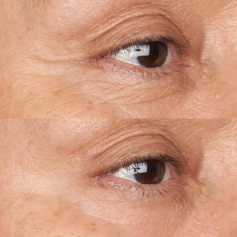 Hypoallergenic Clean Correction Firming & Brightening Eye Cream antes y después
