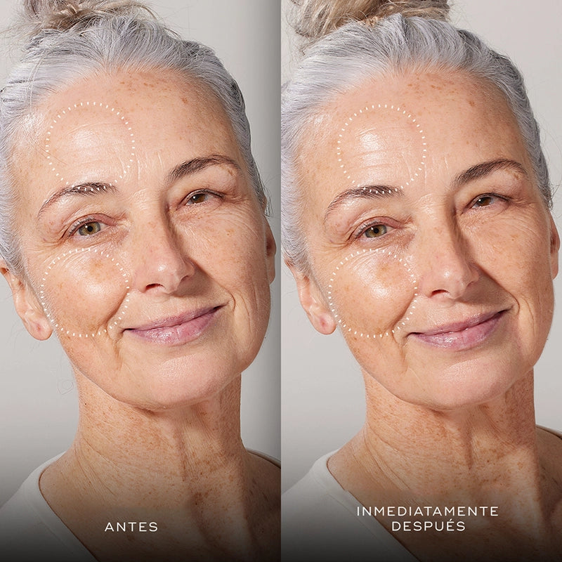 Antes y después de la aplicación de Medik8 Total Moisture Daily Facial Cream