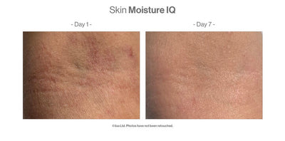 Skin Moisture IQ