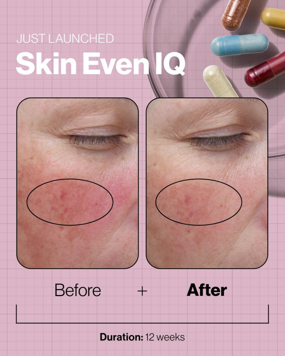 Skin Even IQ ADVANCED NUTRITION PROGRAMME