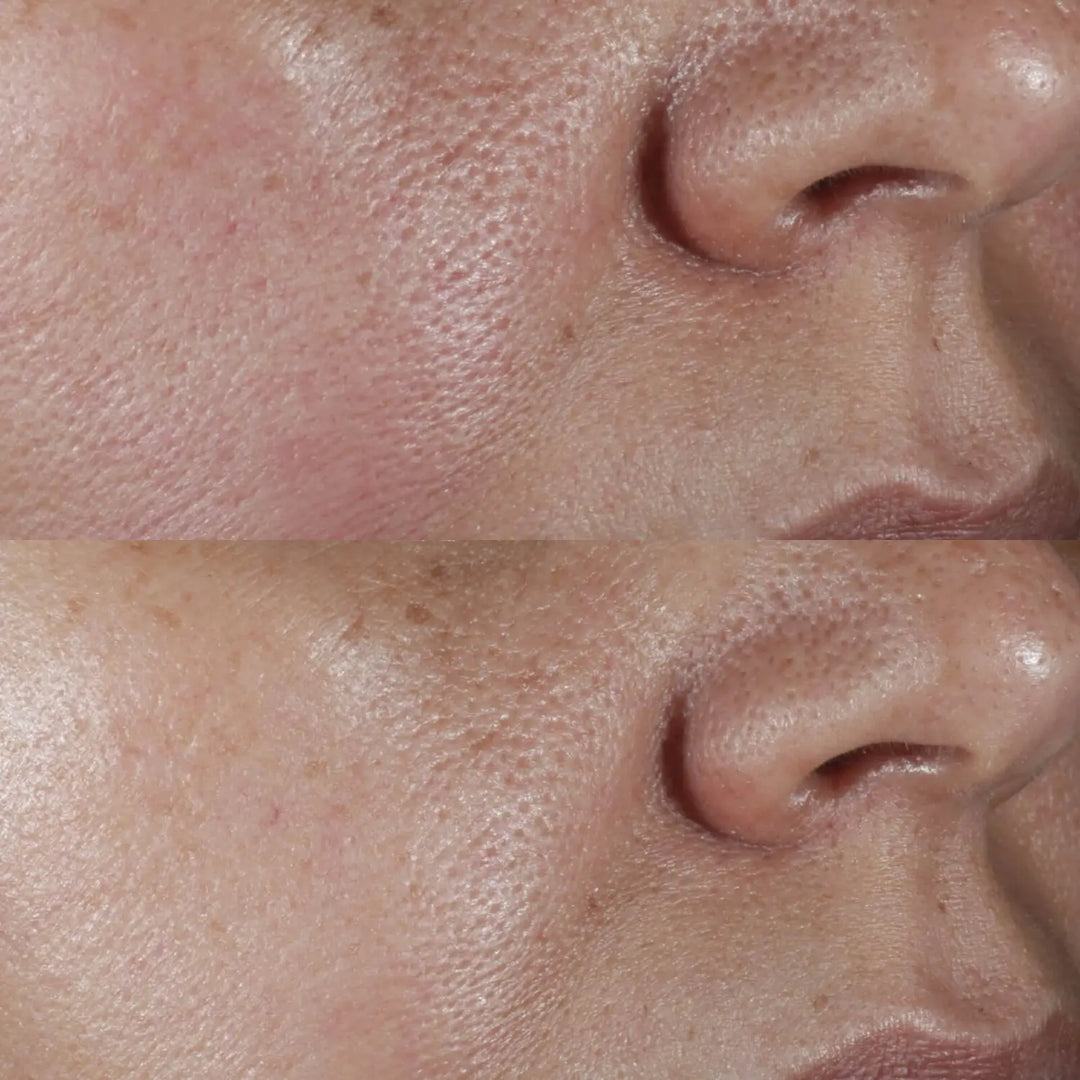 No:Rinse Intensive Pore Minimizing Toner - Perricone MD - Pure Niche Lab