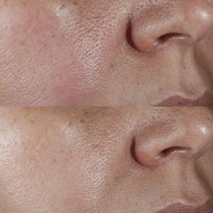 No:Rinse Intensive Pore Minimizing Toner - Perricone MD - Pure Niche Lab