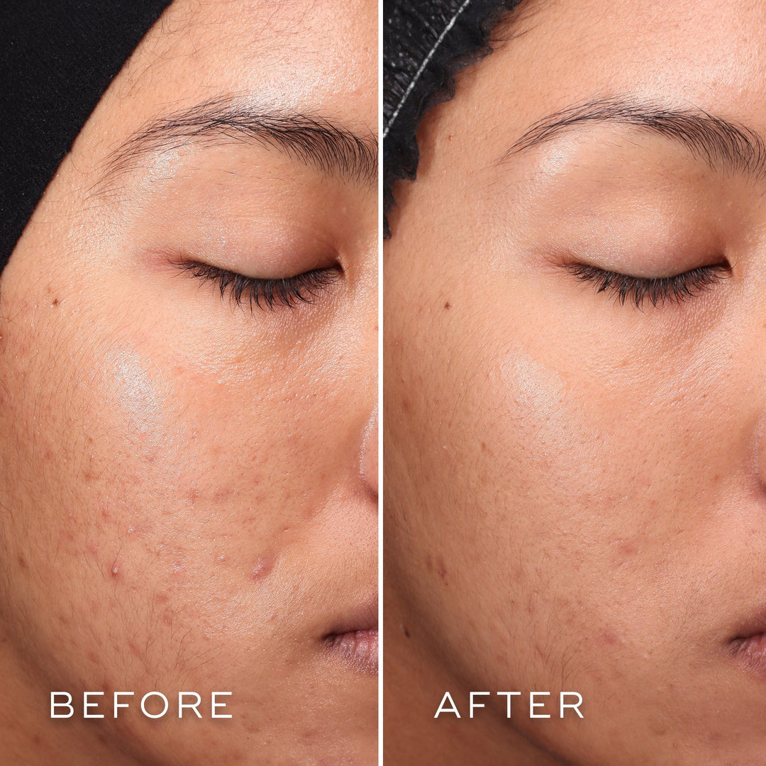 Press &amp;  Clear Refill - Medik8 - Pure Niche Lab