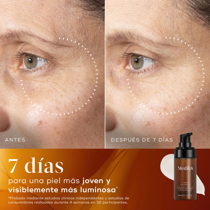 Imágenes de antes y después de 7 días de usar C-Tetra Advanced. La piel se nota más joven y visiblemente más luminosa.