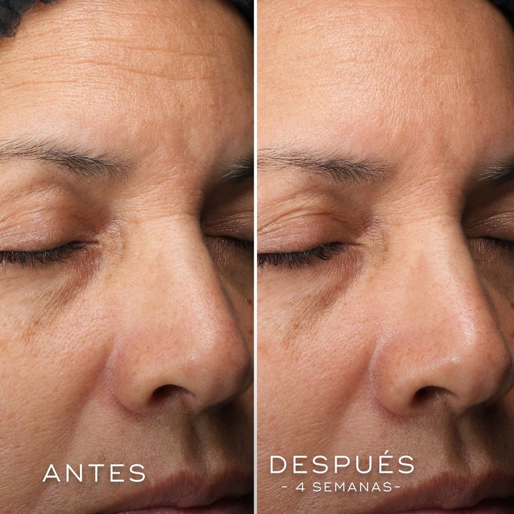 C-Tetra Luxe - Medik8 - Pure Niche Lab