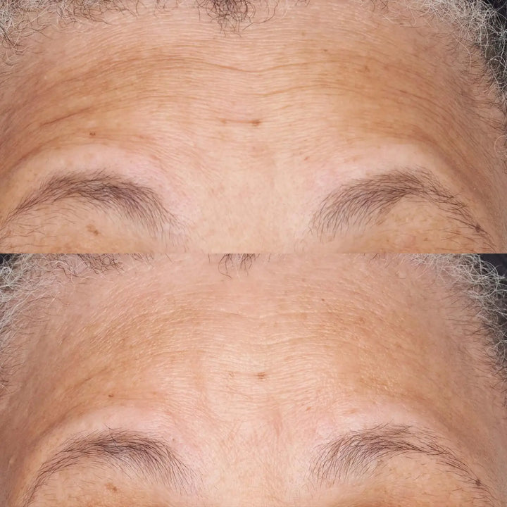 Hypoallergenic Clean Correction Barrier Repair Nourishing Moisturizer resultados