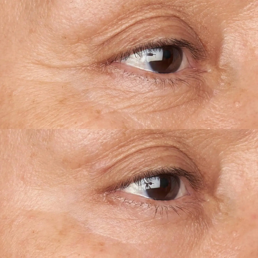 Hypoallergenic Clean Correction Firming &amp; Brightening Eye Cream antes y después