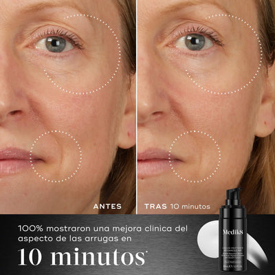 Medik8 Liquid Peptides Advanced antes y después de uso