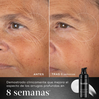 Medik8 Liquid Peptides Advanced antes y después de usar durante 8 semanas