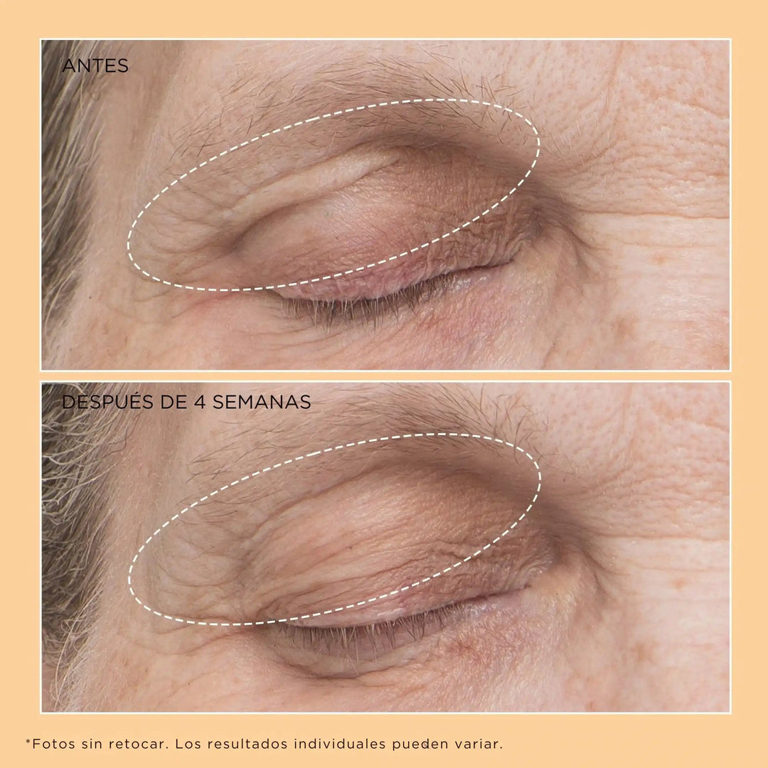 Neuropeptide Eyelid Lift Serum - Perricone MD - Pure Niche Lab