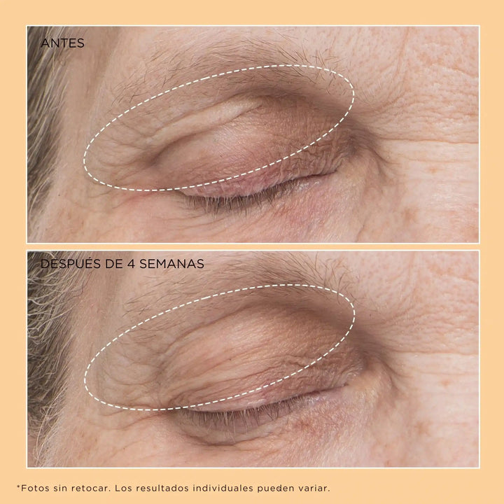 Neuropeptide Eyelid Lift Serum - Perricone MD - Pure Niche Lab
