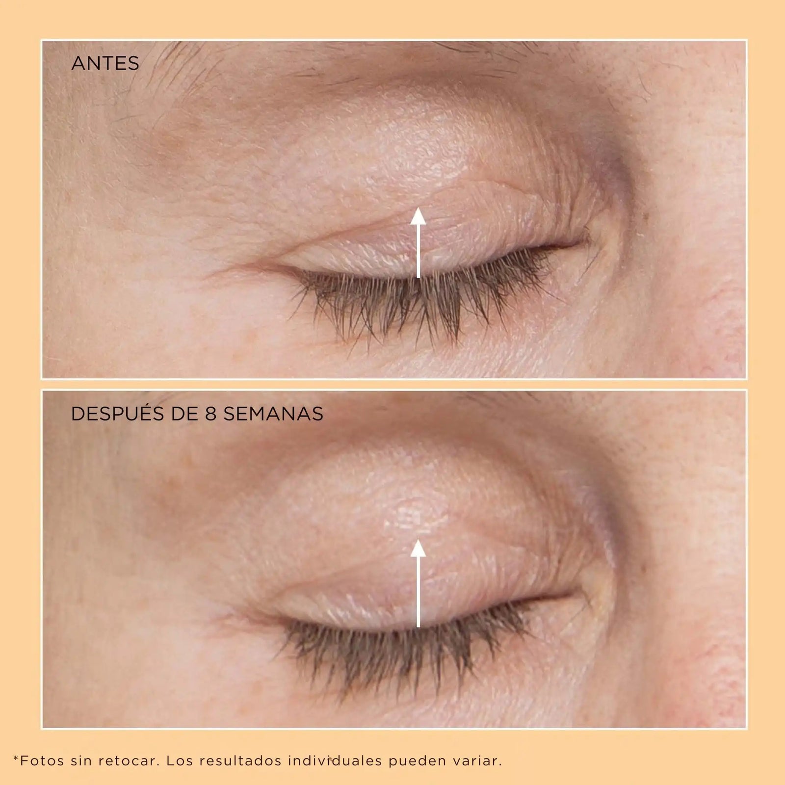 Neuropeptide Eyelid Lift Serum - Perricone MD - Pure Niche Lab
