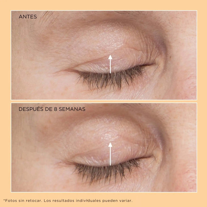 Neuropeptide Eyelid Lift Serum - Perricone MD - Pure Niche Lab