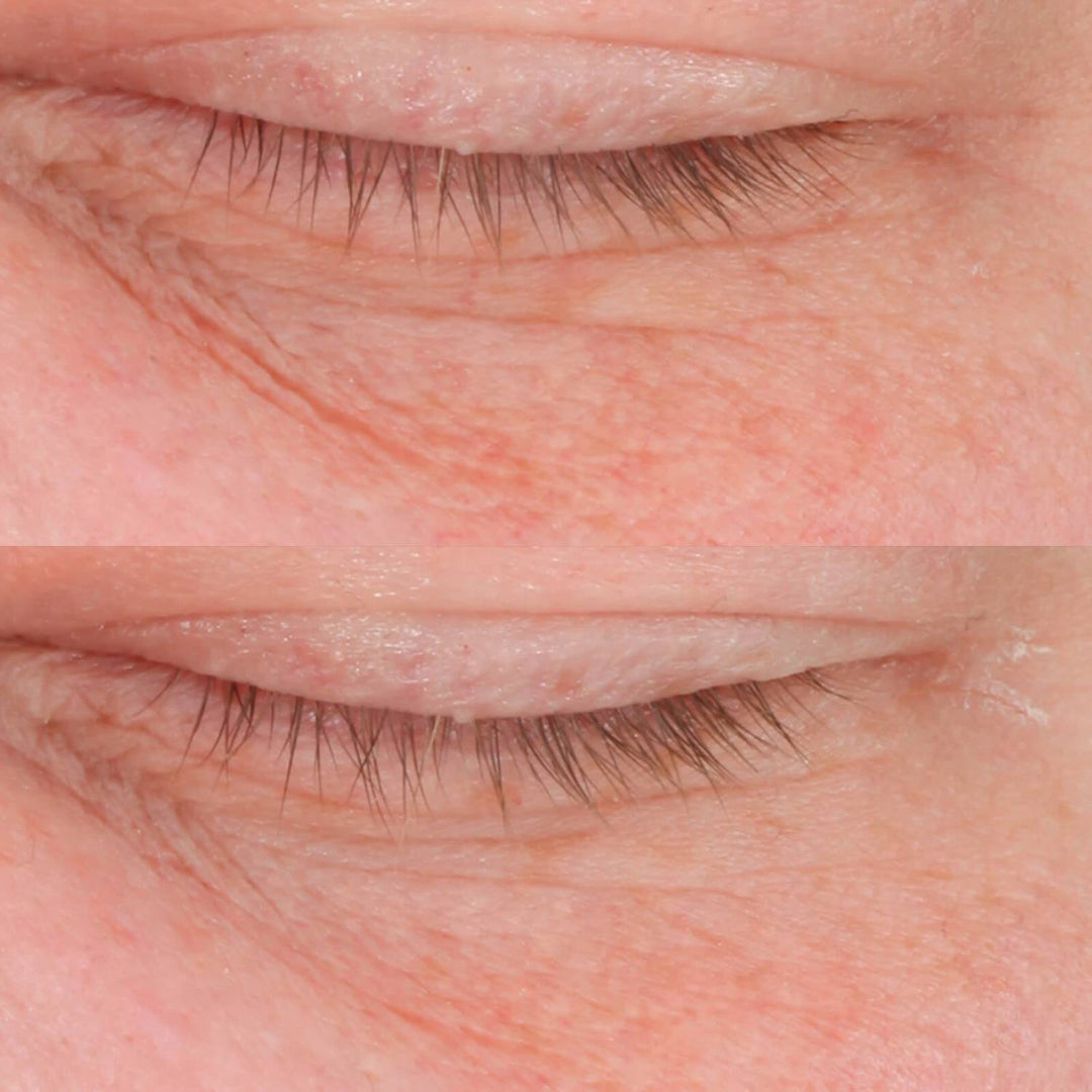 Cold Plasma Plus+ Eye - Perricone MD - Pure Niche Lab