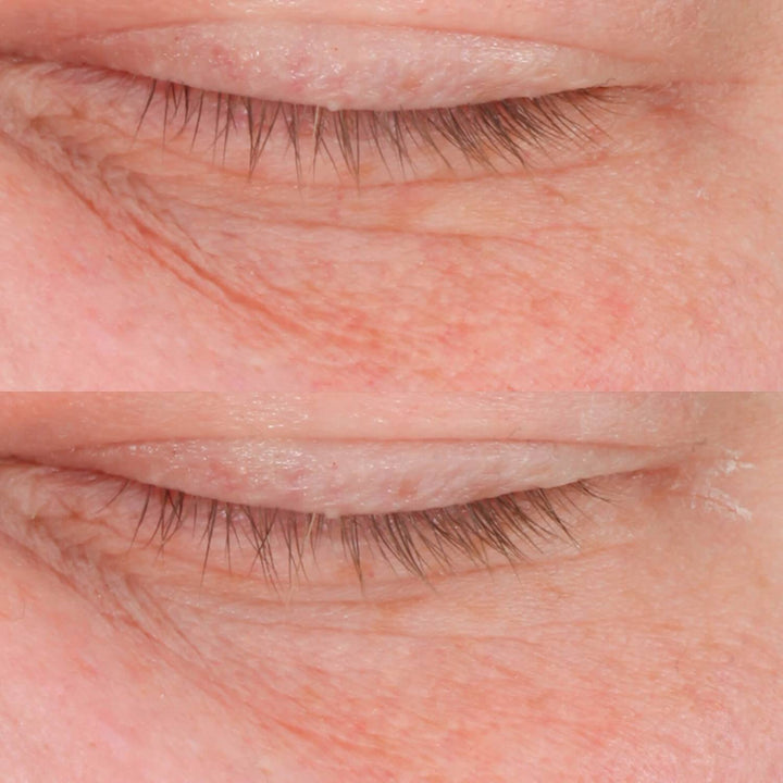 Cold Plasma Plus+ Eye - Perricone MD - Pure Niche Lab