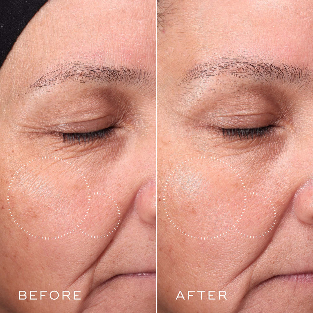 Press &amp; Glow - Medik8 - Pure Niche Lab