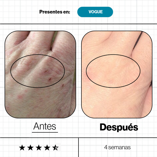 Skin Omegas - Advanced Nutrition Programme - Pure Niche Lab