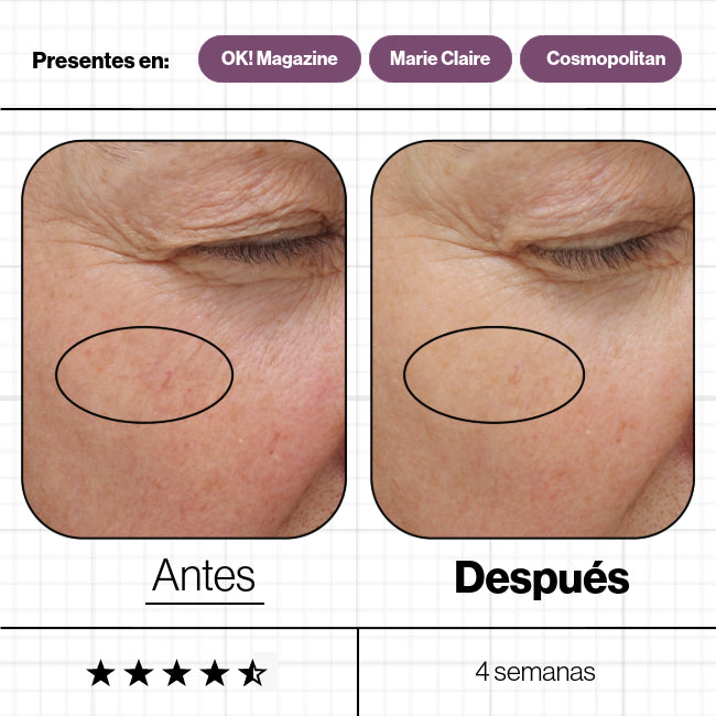 Skin Ultimate - Advanced Nutrition Programme - Pure Niche Lab