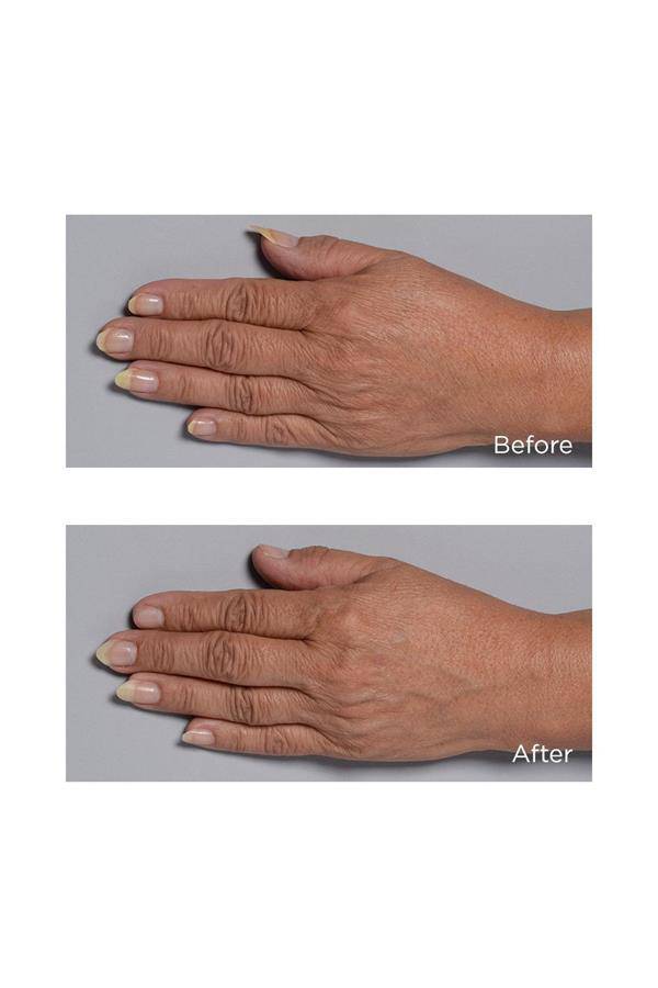 Cold Plasma Plus+ Hand Therapy - Perricone MD - Pure Niche Lab
